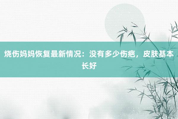 烧伤妈妈恢复最新情况：没有多少伤疤，皮肤基本长好